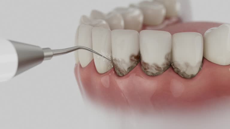 Reliable Dental Implants contractor in Spring Lake, MI by Smile Center Dentistry